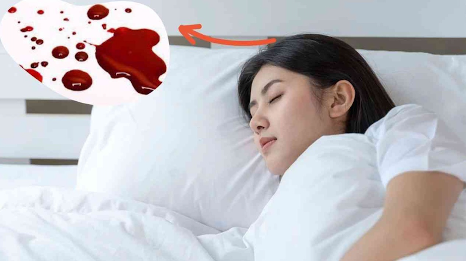 Ý nghĩa phong thủy khi mơ thấy máu Ý nghĩa phong thủy khi mơ thấy máu